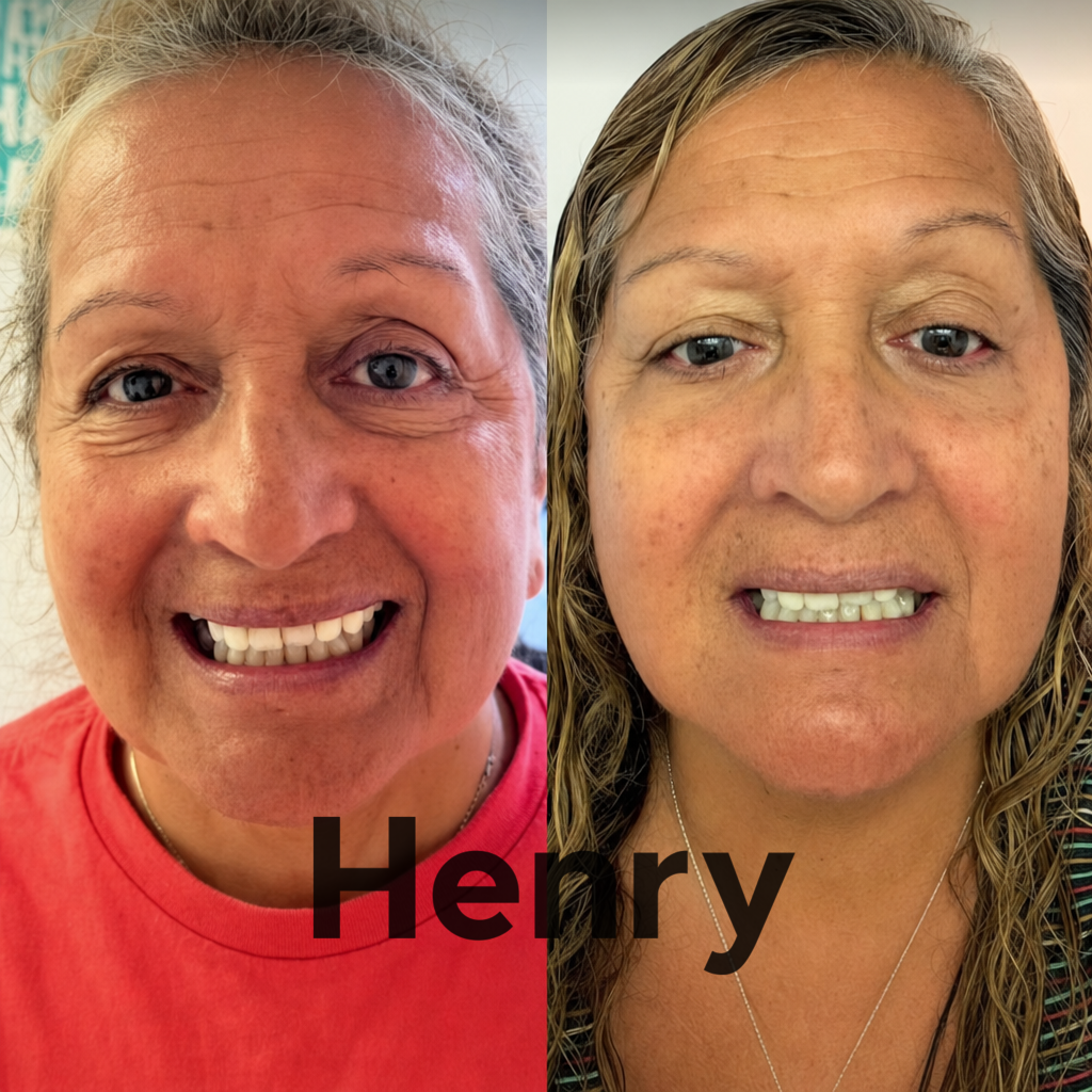 Henry™ Skin Device + Conductive Gel